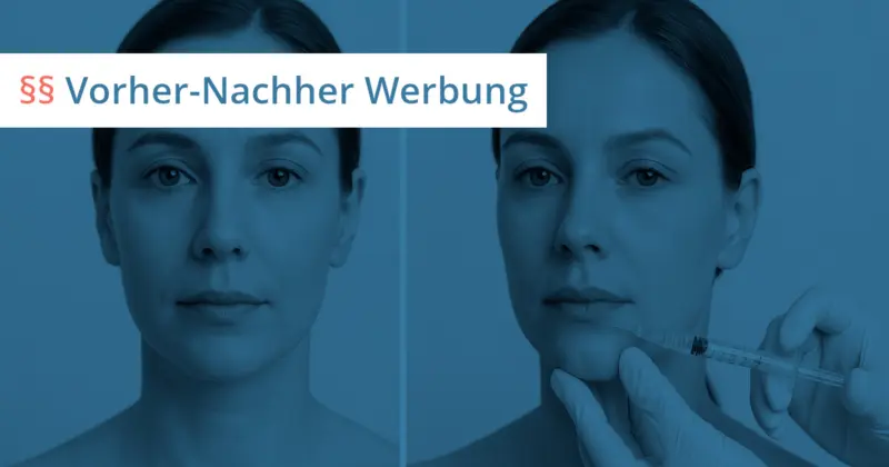 vorher nachher fotos